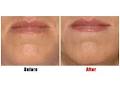 Suppelle Cosmetic Injections image 6