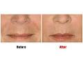 Suppelle Cosmetic Injections image 1