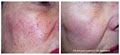 Skin Renu - Laser & Skin Rejuvenation Clinic image 2