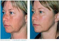 Skin Renu - Laser & Skin Rejuvenation Clinic image 1