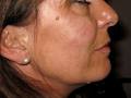 Clinic of Cosmetic Medicine, specialising in wrinkle treatments and liposuction image 2