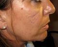 Clinic of Cosmetic Medicine, specialising in wrinkle treatments and liposuction image 1