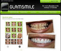 GlamSmile - Dental Porcelain Veneers image 6