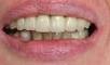 A Better Smile Dental Centre image 4