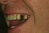 A Better Smile Dental Centre image 5