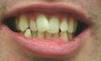 A Better Smile Dental Centre image 6