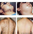 Evolution Laser Hair Removal Clinic image 1