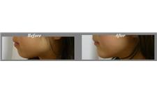 Advance Beauty Cosmetic Surgery- Sydney, NSW image 5