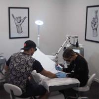 Advanced Tattoo Removal Gold Coast image 5