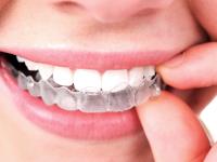 Richmond Family Dental - Invisalign In Melbourne image 2