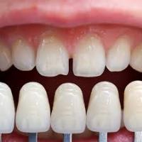 David Rozek Denture Clinic image 1