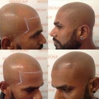 Novoscalp Micropigmentation Clinic image 4