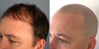 Novoscalp Micropigmentation Clinic image 2