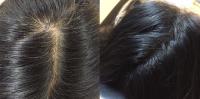 Novoscalp Micropigmentation Clinic image 3