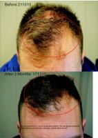 Australian Hair & Scalp Clinic (Aushair) image 1