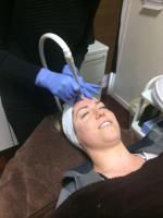 Refine Skin Laser image 2