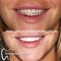 Civic Gentle Dental Care image 6