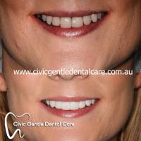 Civic Gentle Dental Care image 5