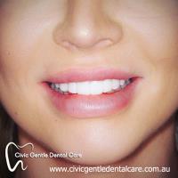 Civic Gentle Dental Care image 4