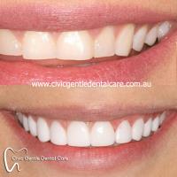 Civic Gentle Dental Care image 3