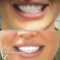 Civic Gentle Dental Care image 2