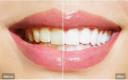 Cosmetic Dentistry in Eastern Melbourne logo