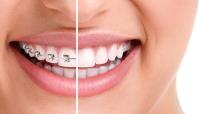 Orthodontics Melbourne image 1