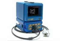 BCF Ultrasound image 1