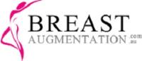 Breast Augmentation image 1
