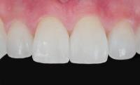 Gold Coast Dental Studio image 3