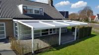 Balcony Shades - Retractable Pergola Systems image 5