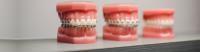 Cheap Orthodontist Gold Coast image 3