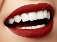 Cheap Orthodontist Gold Coast image 2