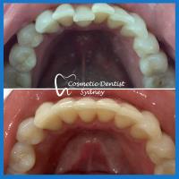 Cosmetic Dentist Sydney image 4