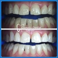 Cosmetic Dentist Sydney image 2