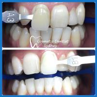 Cosmetic Dentist Sydney image 3