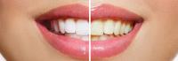 Dentists Moonee Ponds Victoria image 3