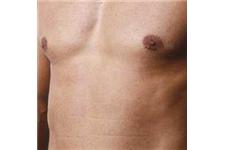 Australian Laser & Skin Clinic image 14