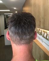 CRLab Australia - Hair Loss Scalp Clinic image 2