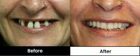 Pearl Denture Studio | Mullumbimby Denture Clinic image 3