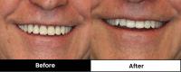 Pearl Denture Studio | Casino Denture Clinic image 3