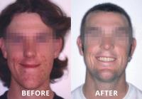 Illawarra Oral and Maxillofacial Surgery image 8