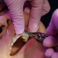 Leichhardt Dental image 5