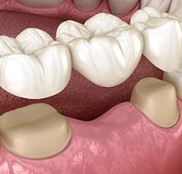 Killoran Dental image 2