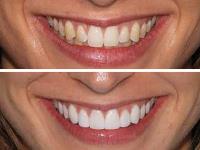 Cosmetic Dentist Sydney image 1