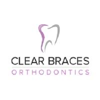 Clear Braces Orthodontics image 1