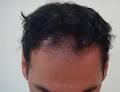 Australian Institute of Hair Restoration image 5