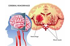 Klint Intensive Neuro Therapies image 1