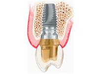 National Periodontics image 6