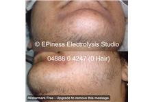 EPIness Electrolysis Studio image 4